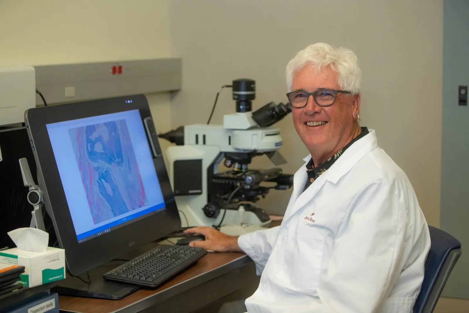 Study links SOD1 to immune defences in Down syndrome