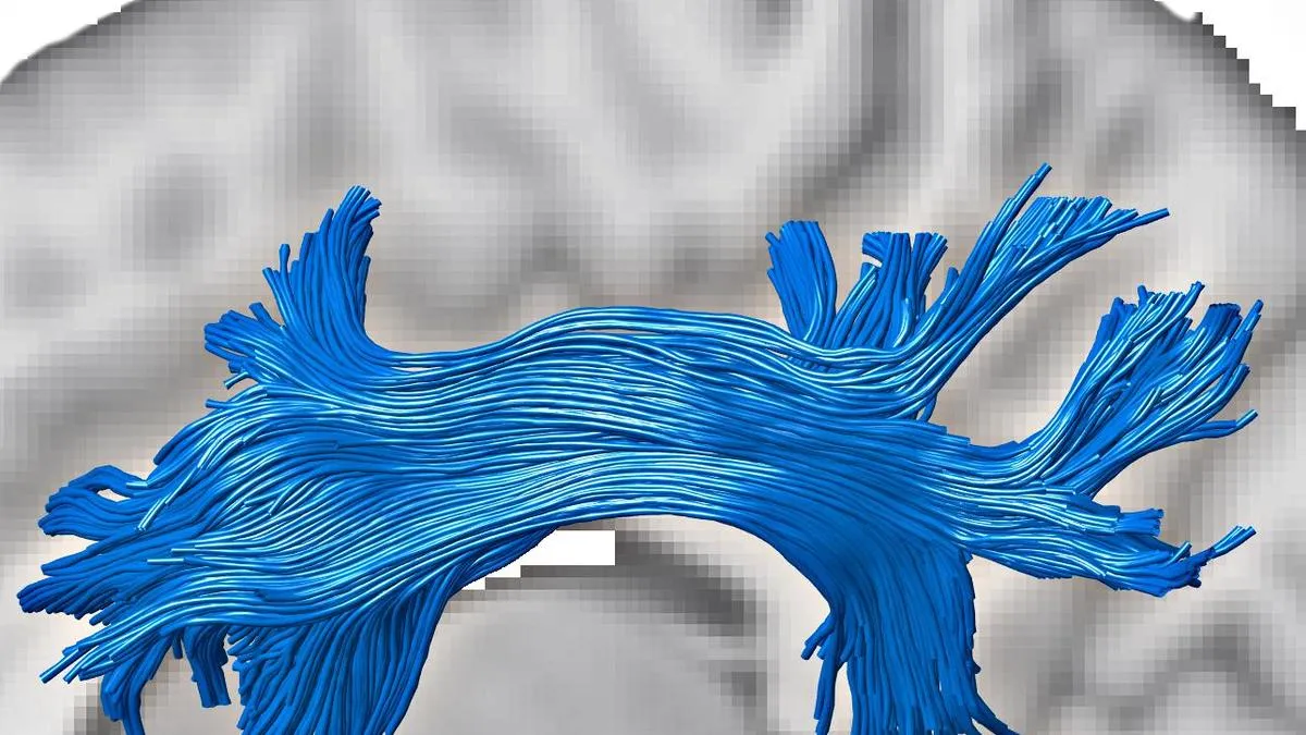 Brain's white matter may offset effects of cognitive decline